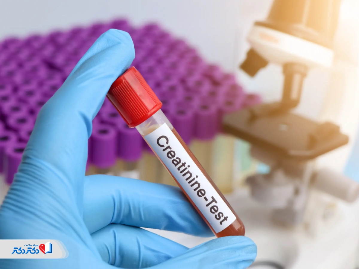 آزمایش خون سنگ کلیه