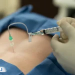 آزمایش ام اس چیست؟ راهنمای تشخیص این بیماری خودایمن