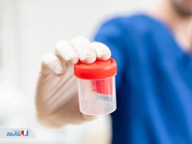 همه چیز درباره نحوه انجام آزمایش اعتیاد و نکات مهمی که قبل از انجام تست اعتیاد باید بدانید