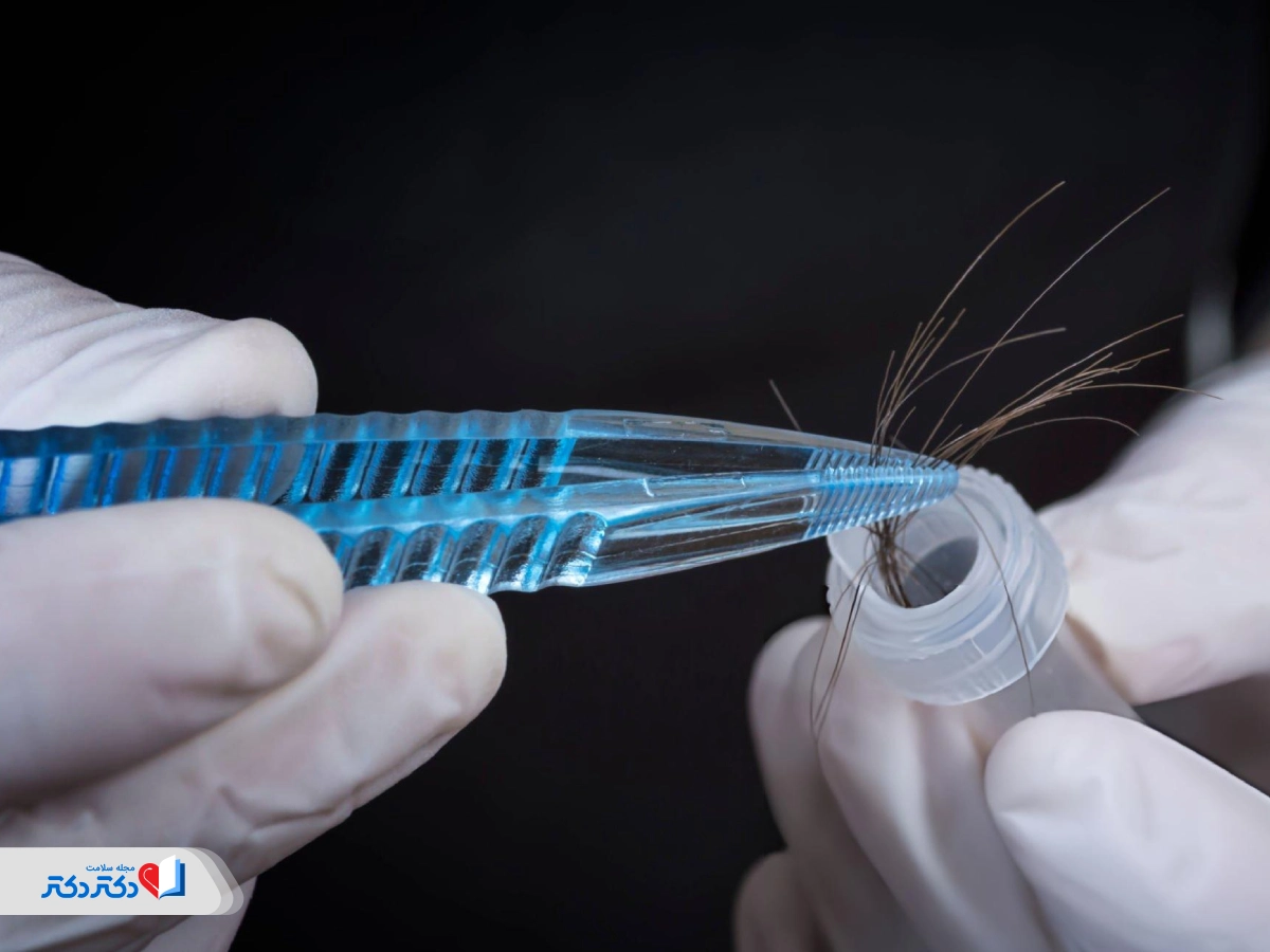 آزمایش مو برای تشخیص اعتیاد