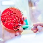 آزمایش عفونت خون چیست؟ روش‌های تشخیص، تفسیر مقادیر نرمال