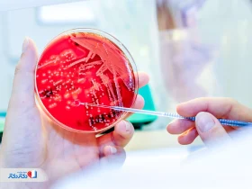 آزمایش عفونت خون چیست؟ روش‌های تشخیص، تفسیر مقادیر نرمال