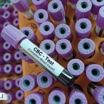 کاربرد آزمایش CBC؛ بررسی سلامت عمومی بدن از طریق خون