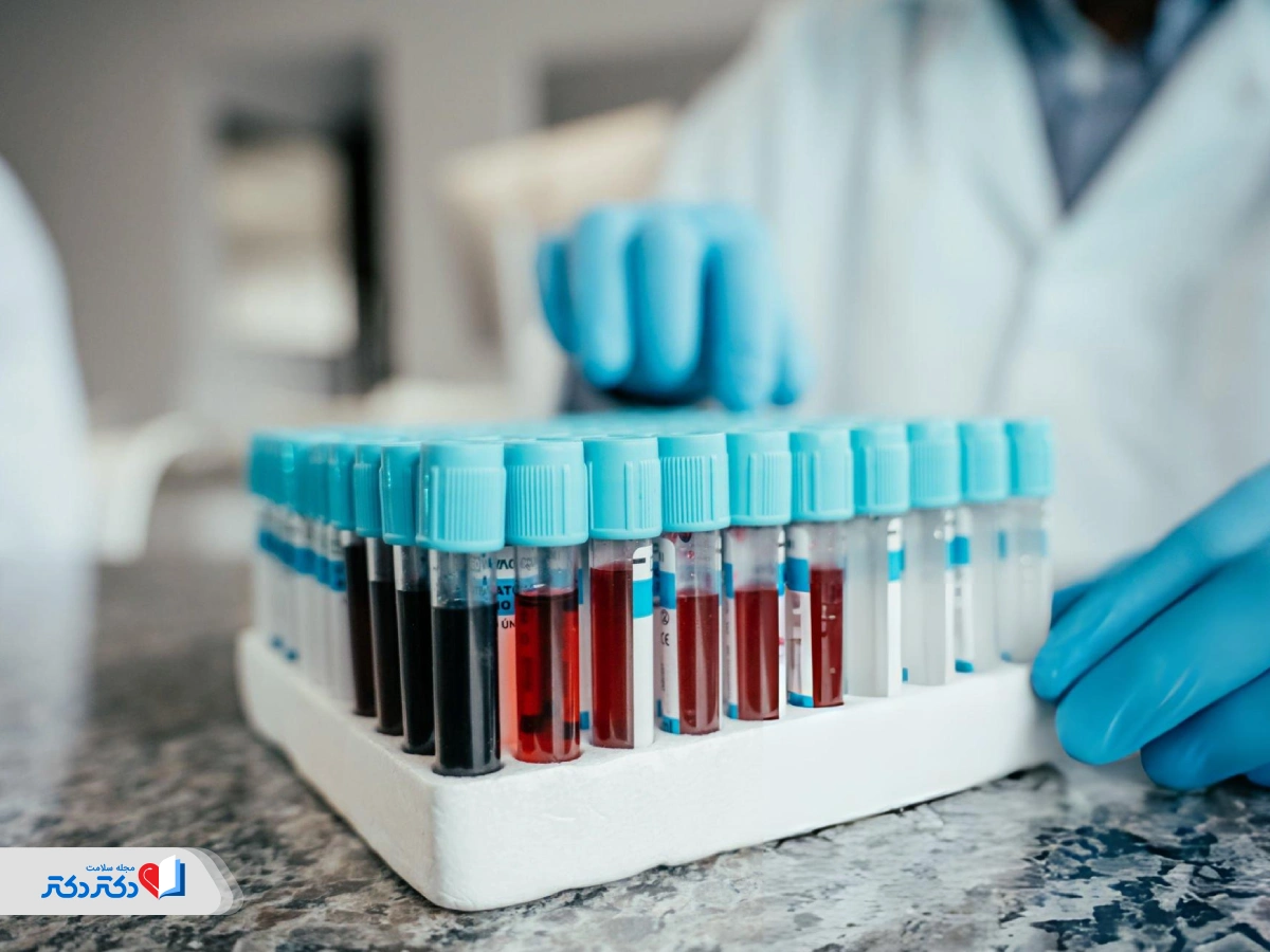 نحوه انجام آزمایش CEA