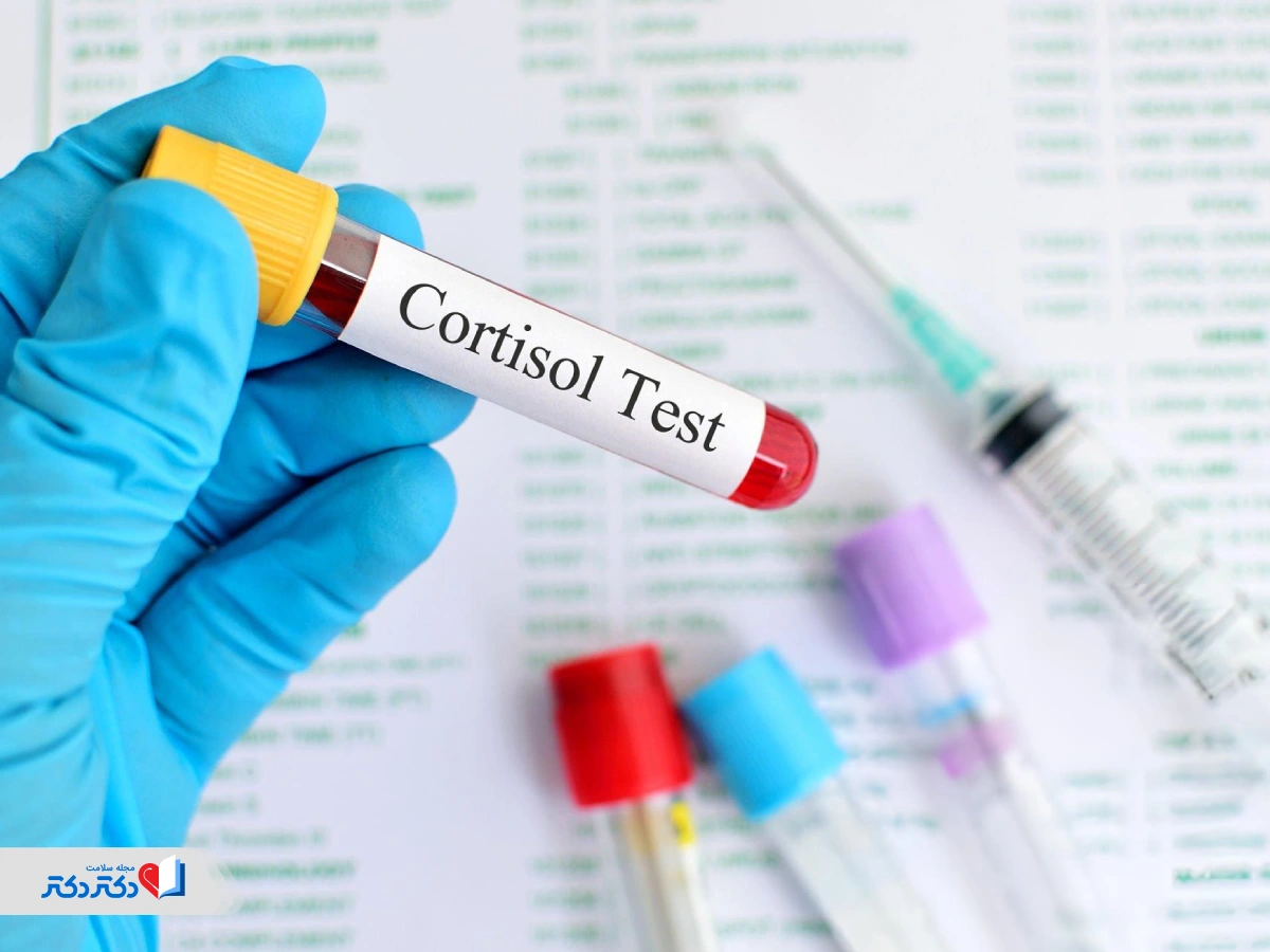 تفسیر آزمایش کورتیزول