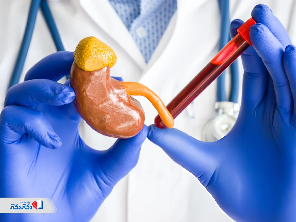 آزمایش کورتیزول-آزمایش کورتیزول چیست و چه کاربردی دارد؟