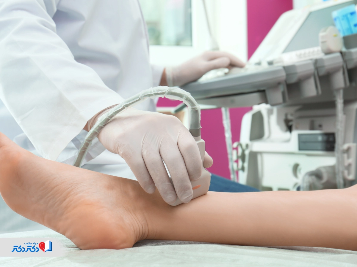 سونو داپلر پا