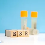 مقدار نرمال ESR در آزمایش خون و ارتباط آن با سرطان خون