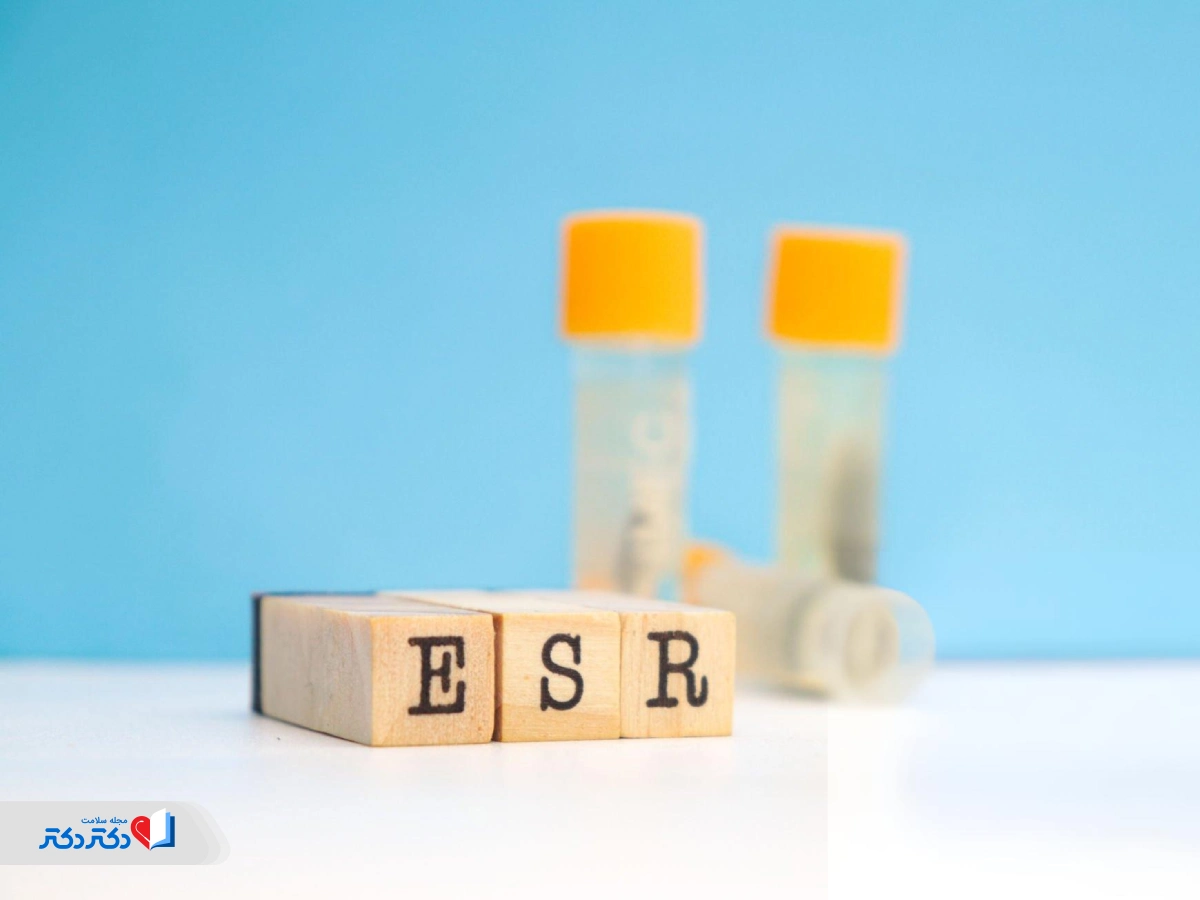 مقدار ESR