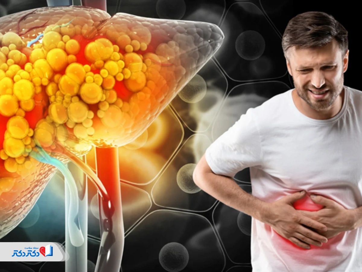 کبد چرب گرید ۲ علائم، درمان و خطر