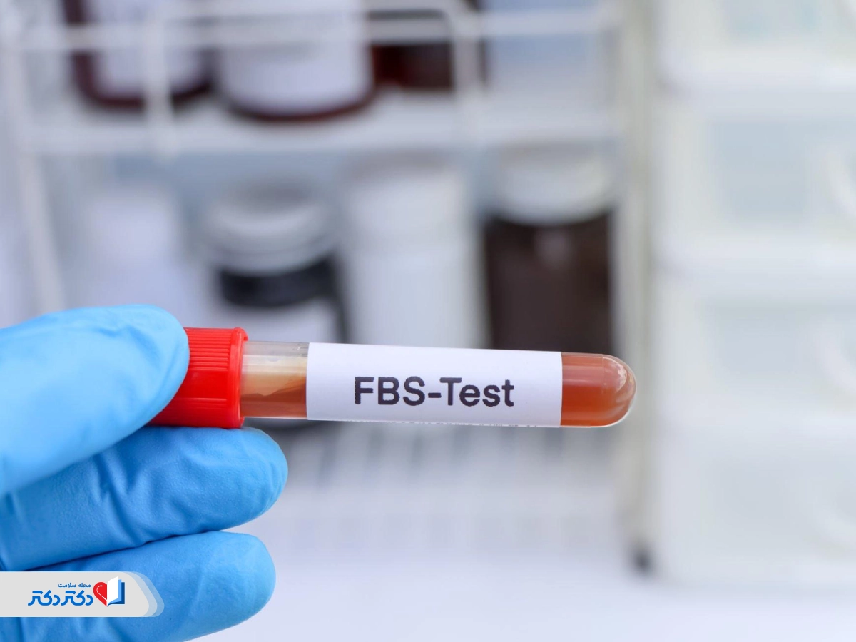 آزمایش قند خون ناشتا