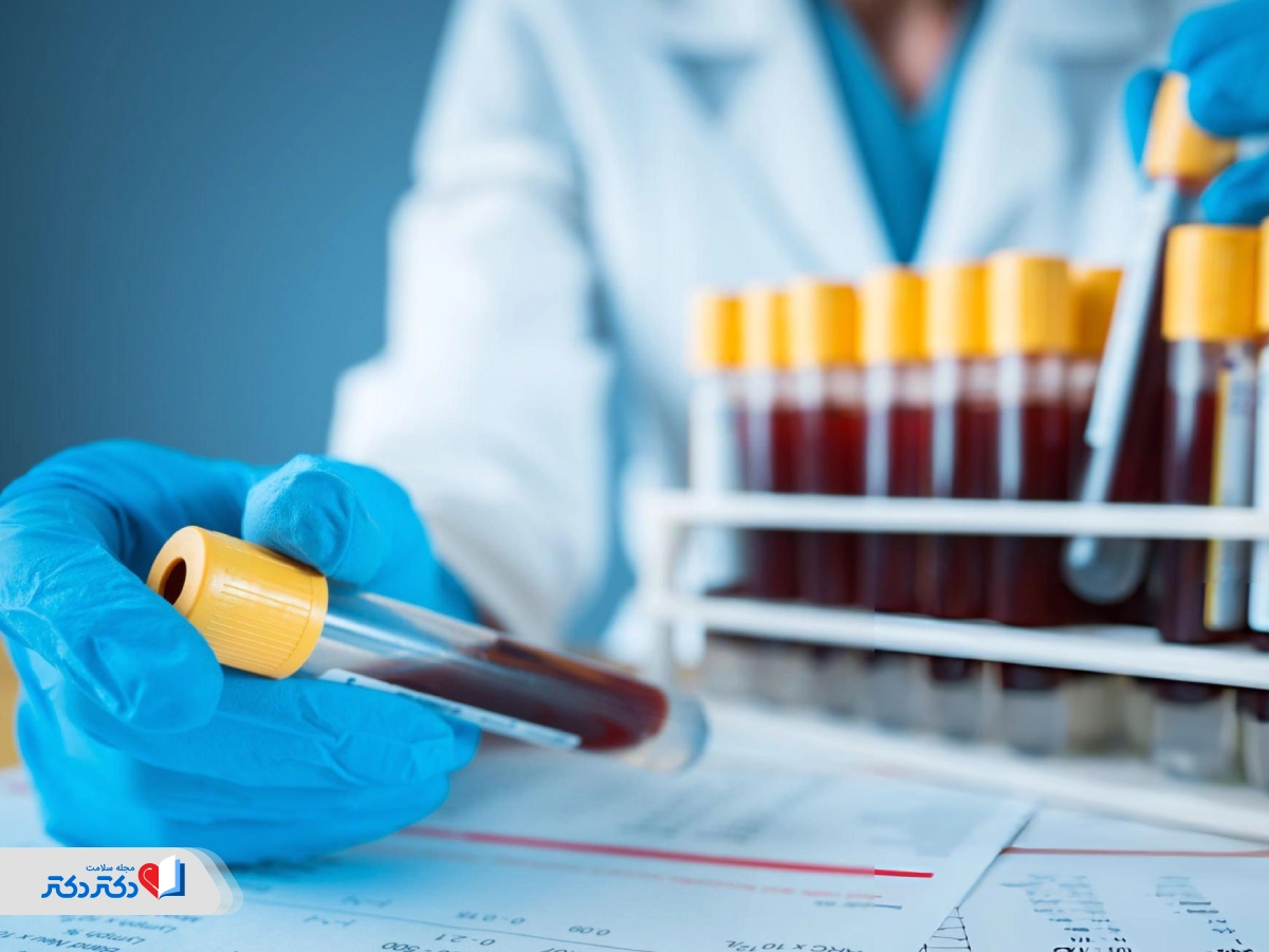 تفسیر نتیجه آزمایش قند خون ناشتا