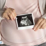 سونوگرافی رشد جنین؛ بررسی وزن، قد و سلامت نوزاد