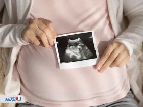 سونوگرافی رشد جنین؛ بررسی وزن، قد و سلامت نوزاد