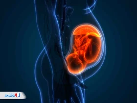 سونوگرافی موقعیت جنین؛ بررسی نحوه قرارگیری نوزاد در رحم