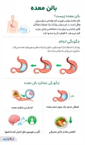اینفوگرافی بالن معده