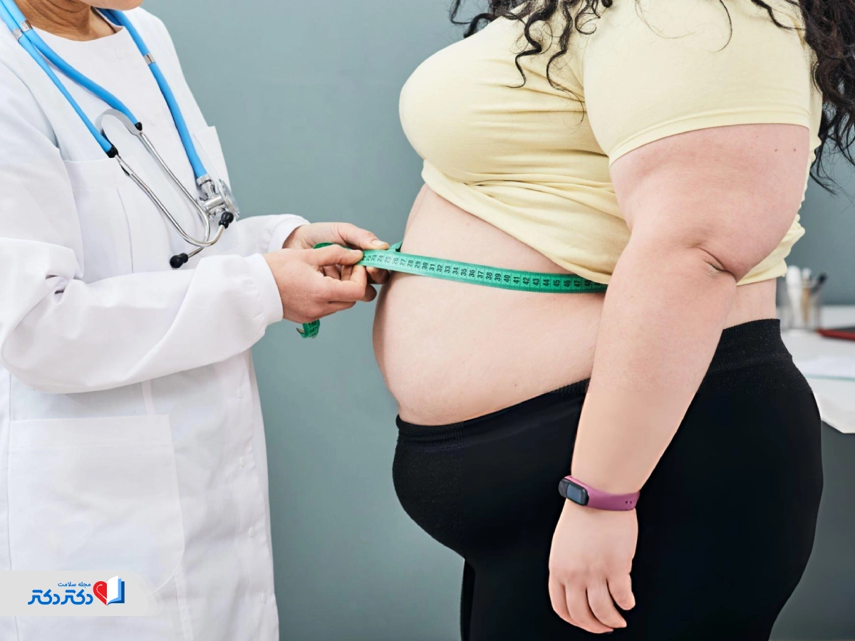 عمل اسلیو معده