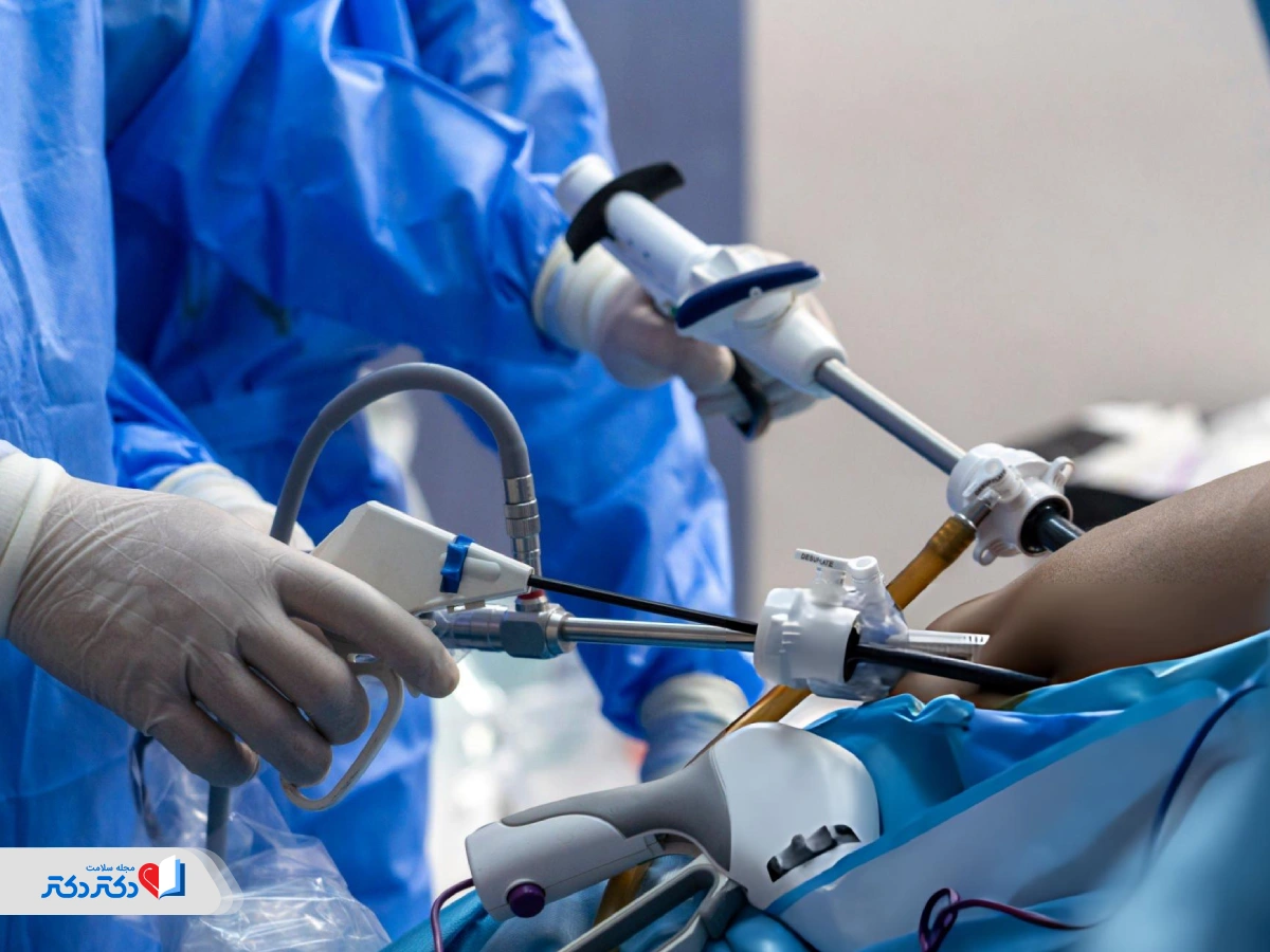 هزینه عمل اسلیو معده در ایران
