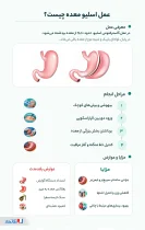 اینفوگرافی اسلیو معده 