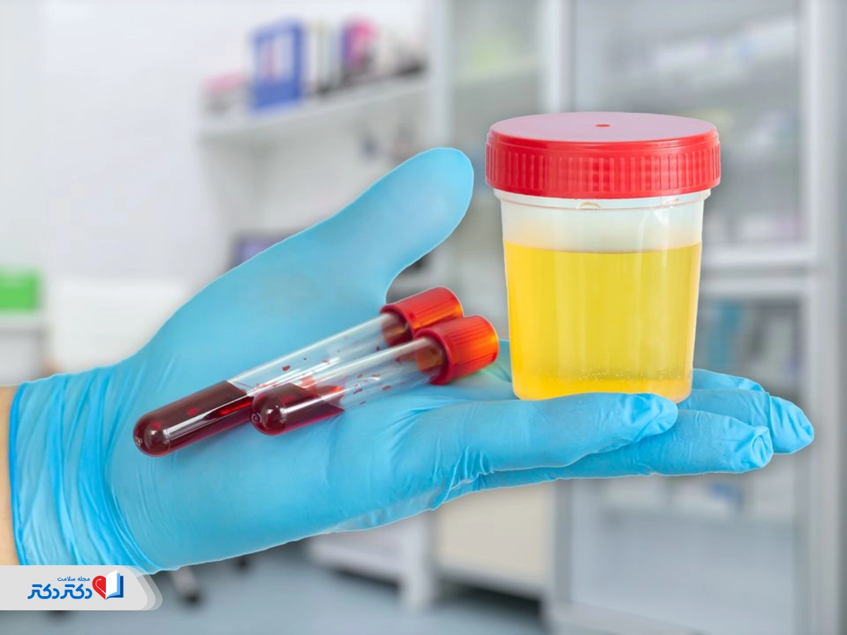 آزمایش کلیه شامل چه تستهایی است؟