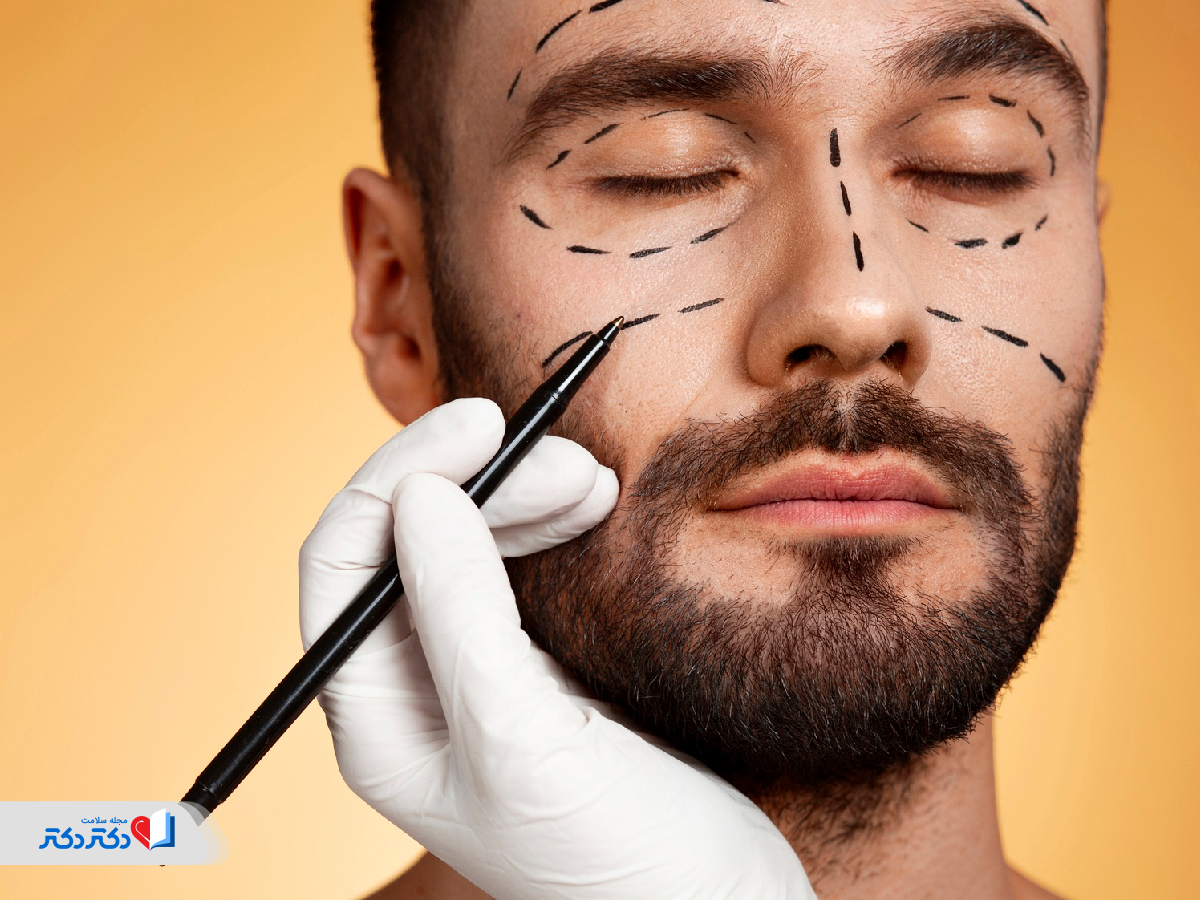 تخلیه چربی صورت چطور انجام می شود؟