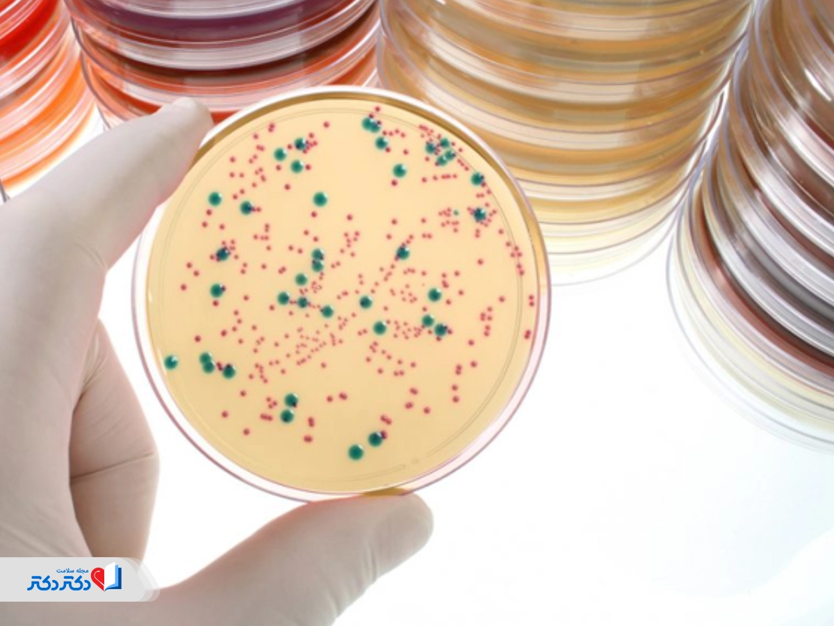 آزمایش الاستاز مدفوع