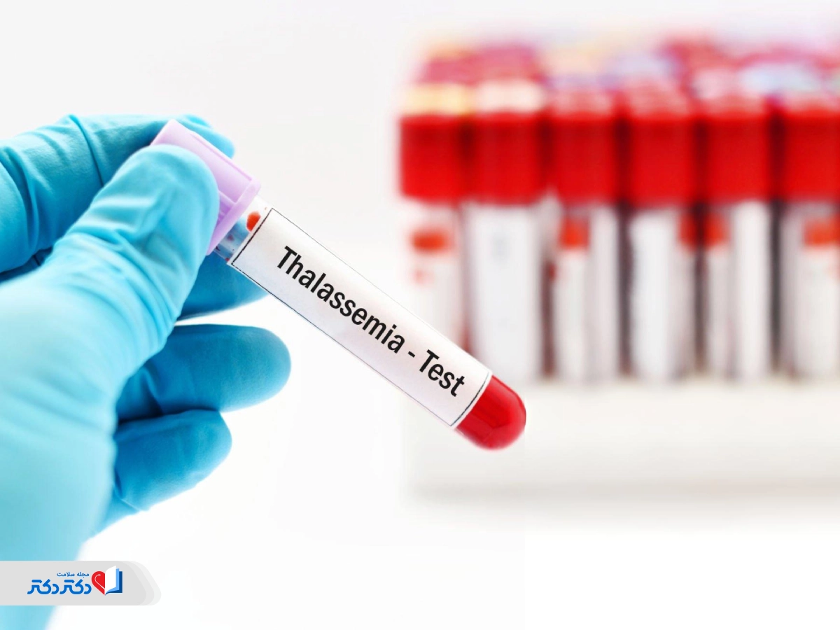 تشخیص تالاسمی در آزمایش خون