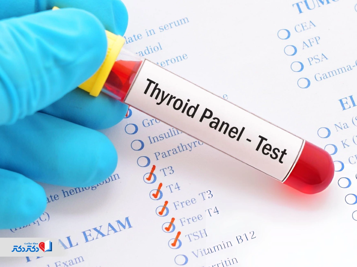 آزمایش تیروئید چیست
