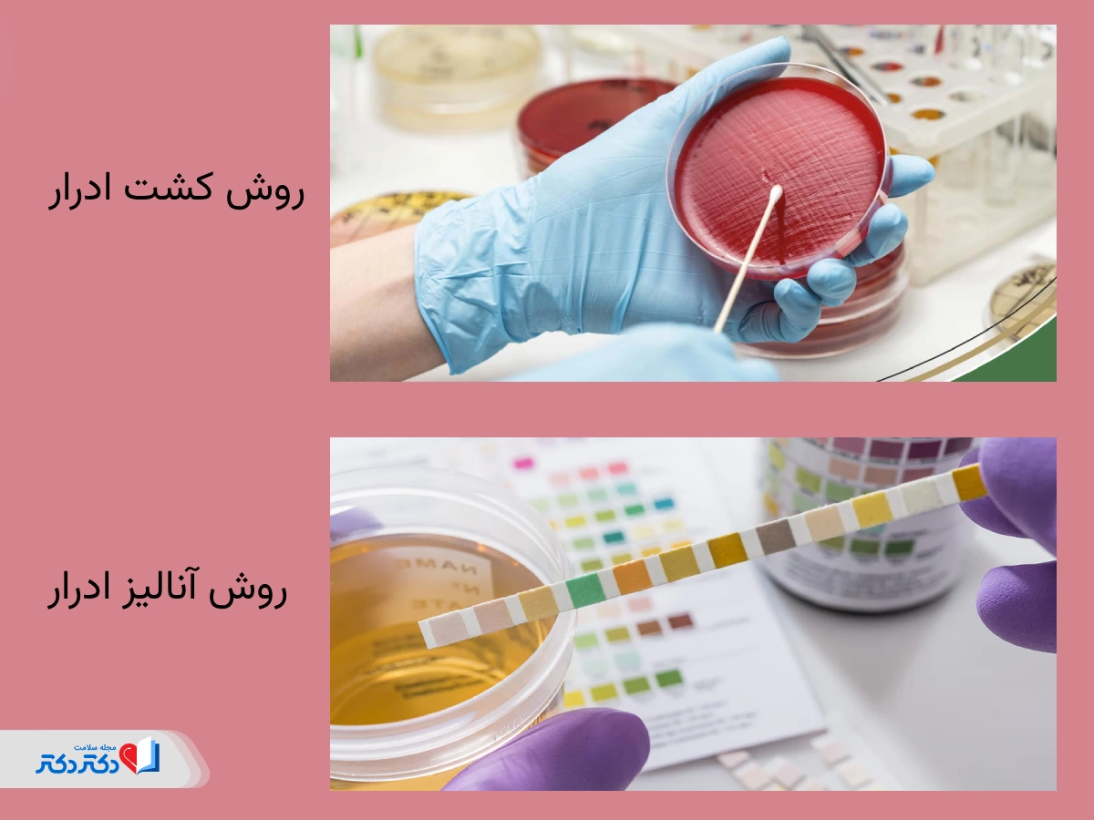 تفاوت کشت ادرار و آنالیز ادرار