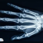 تصویربرداری با اشعه X چیست و در چه مواردی انجام می‌شود؟