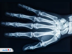 تصویربرداری با اشعه X چیست و در چه مواردی انجام می‌شود؟