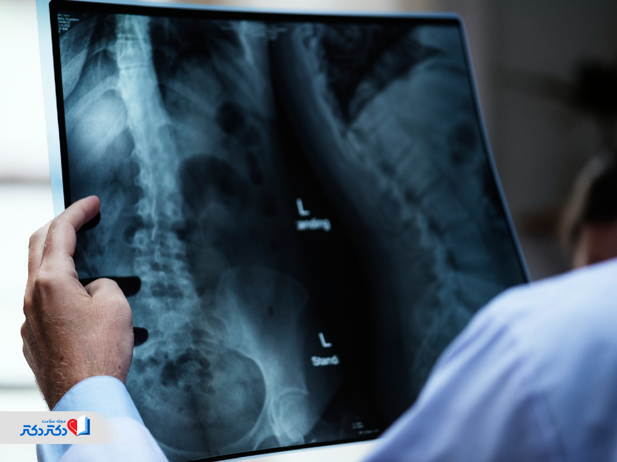 دُز اشعه ایکس در تصویربرداری اندامها