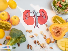 برای دفع سنگ کلیه چه بخوریم؟ + لیست غذاهای مناسب دفع سنگ کلیه