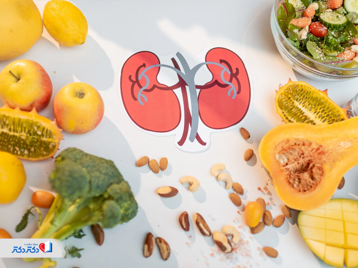 همهچیز درباره اینکه برای دفع سنگ کلیه چه بخوریم؟