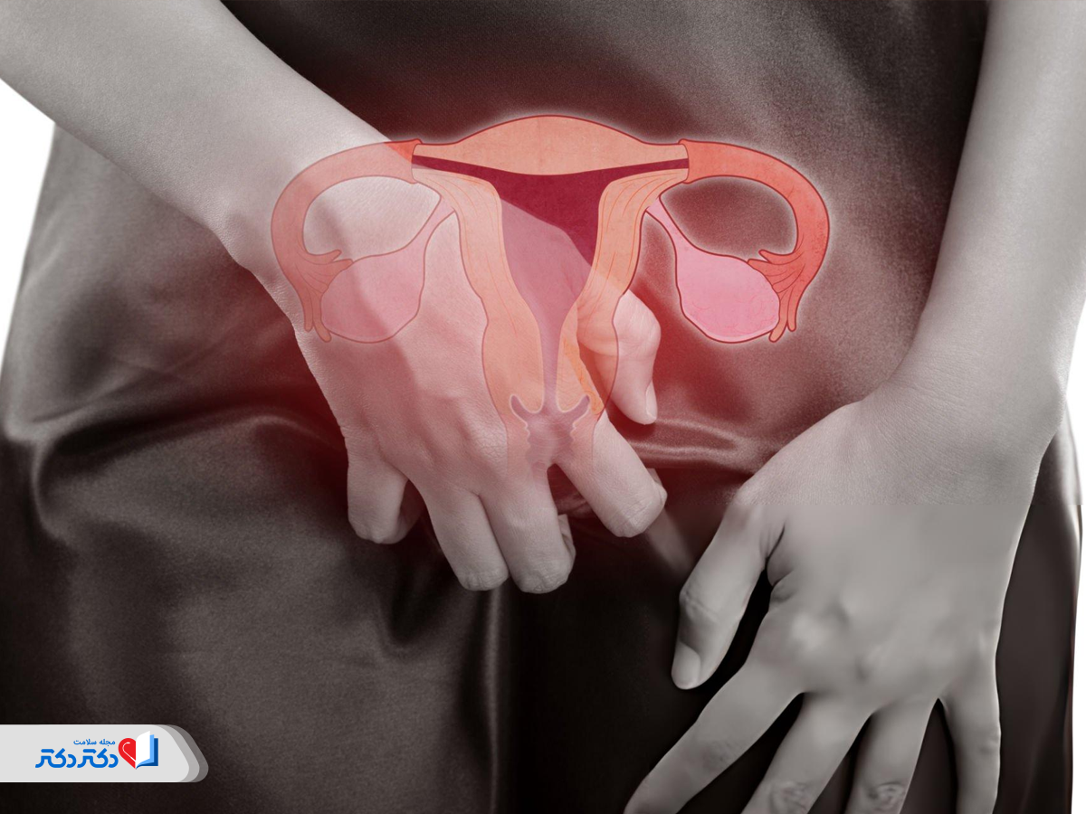 عفونت‌های قارچی مکرر، از علائم دیابت خاموش در زنان