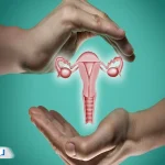 کیست بارتولین چیست؟ از تخلیه کیست تا درمان‌های خانگی مؤثر