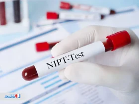 آزمایش NIPT در بارداری؛ مزایا و تفسیر جواب آن