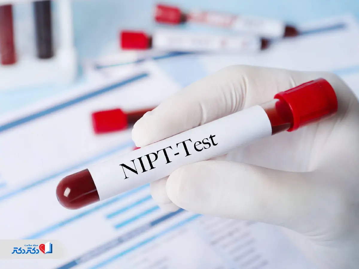 آزمایش NIPT