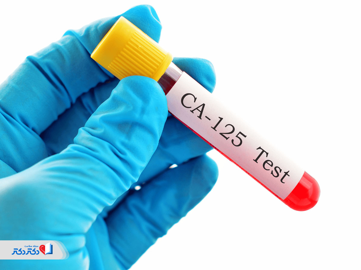 تست CA125 چیست
