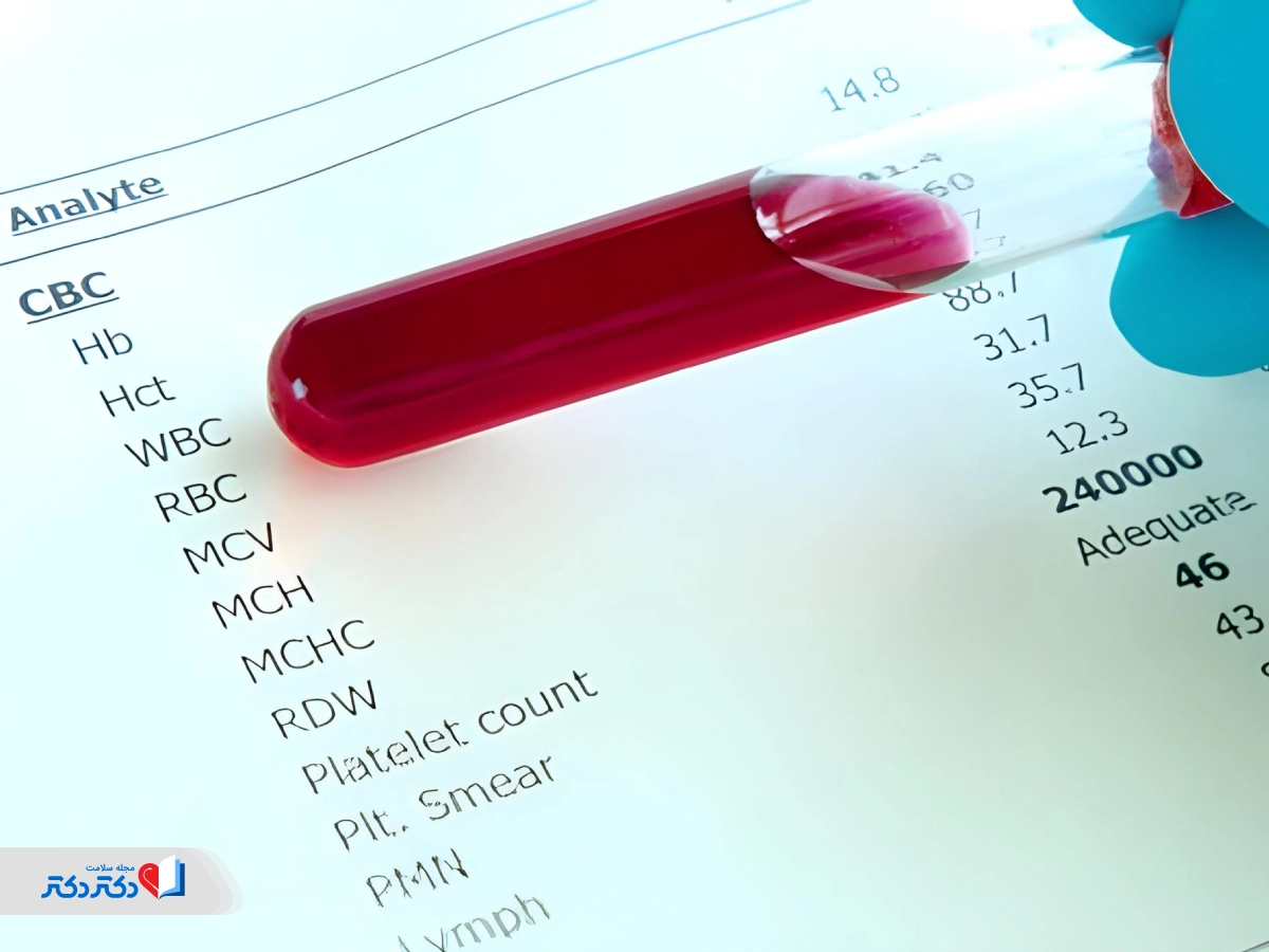 تفسیر MCHC در آزمایش خون در کنار سایر شاخص‌های آزمایش CBC