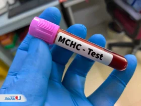 پایین بودن MCHC در آزمایش خون نشانه چیست؟ بررسی علت و درمان