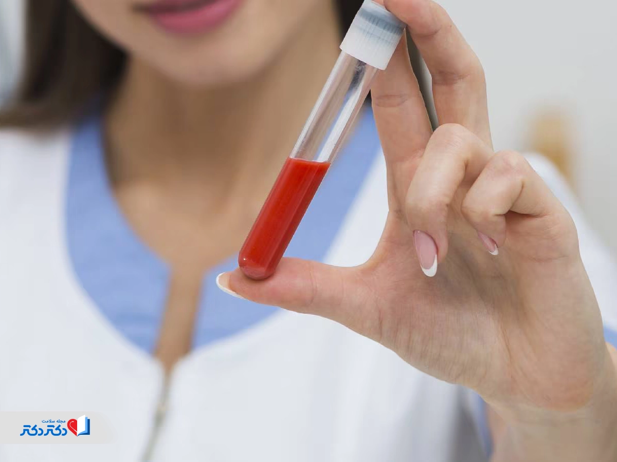 پایین بودن MCHC در آزمایش خون نشانه چیست