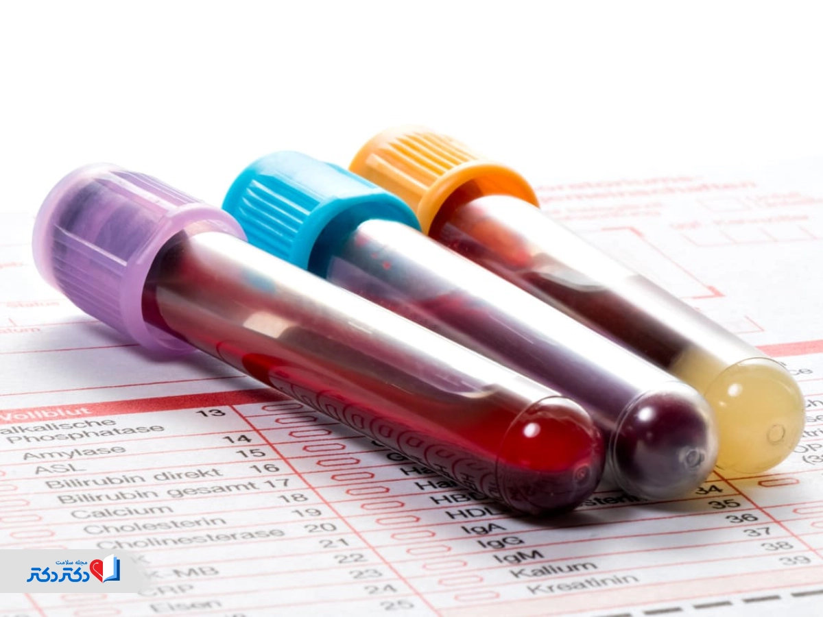 تفاوت MCHC در آزمایش خون با MCH و MCV 
