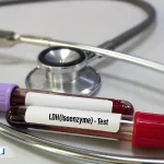 آزمایش LDH چیست و چه اطلاعاتی درباره سلامت بدن می‌دهد؟