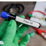 آزمایش T4 چیست و چه نقشی در تشخیص اختلالات تیروئید دارد؟