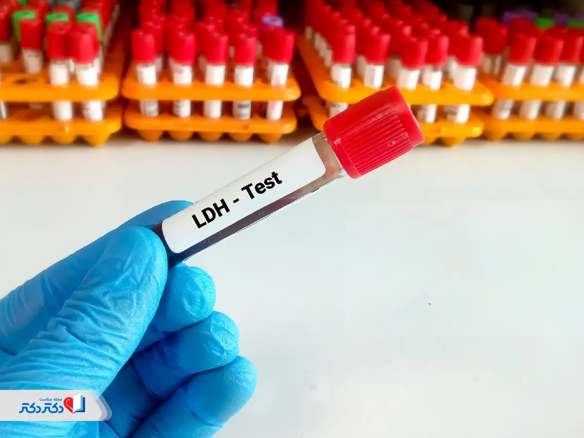 انواع آزمایش LDH