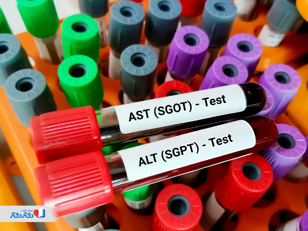 تفاوت آزمایش SGOT با آزمایش SGPT