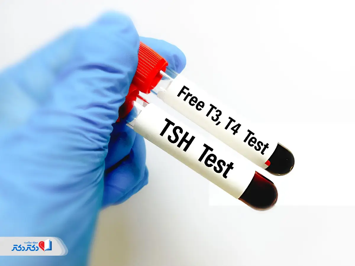 آزمایش T4 همراه با TSH