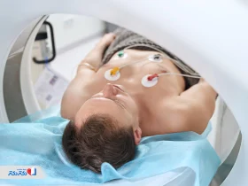 آشنایی با آنژیوگرافی عروق کرونر و نحوه تفسیر آن