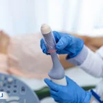 سونوگرافی رحم و تخمدان چیست؟ کاربردها، نحوه آمادگی و تفسیر نتایج آن